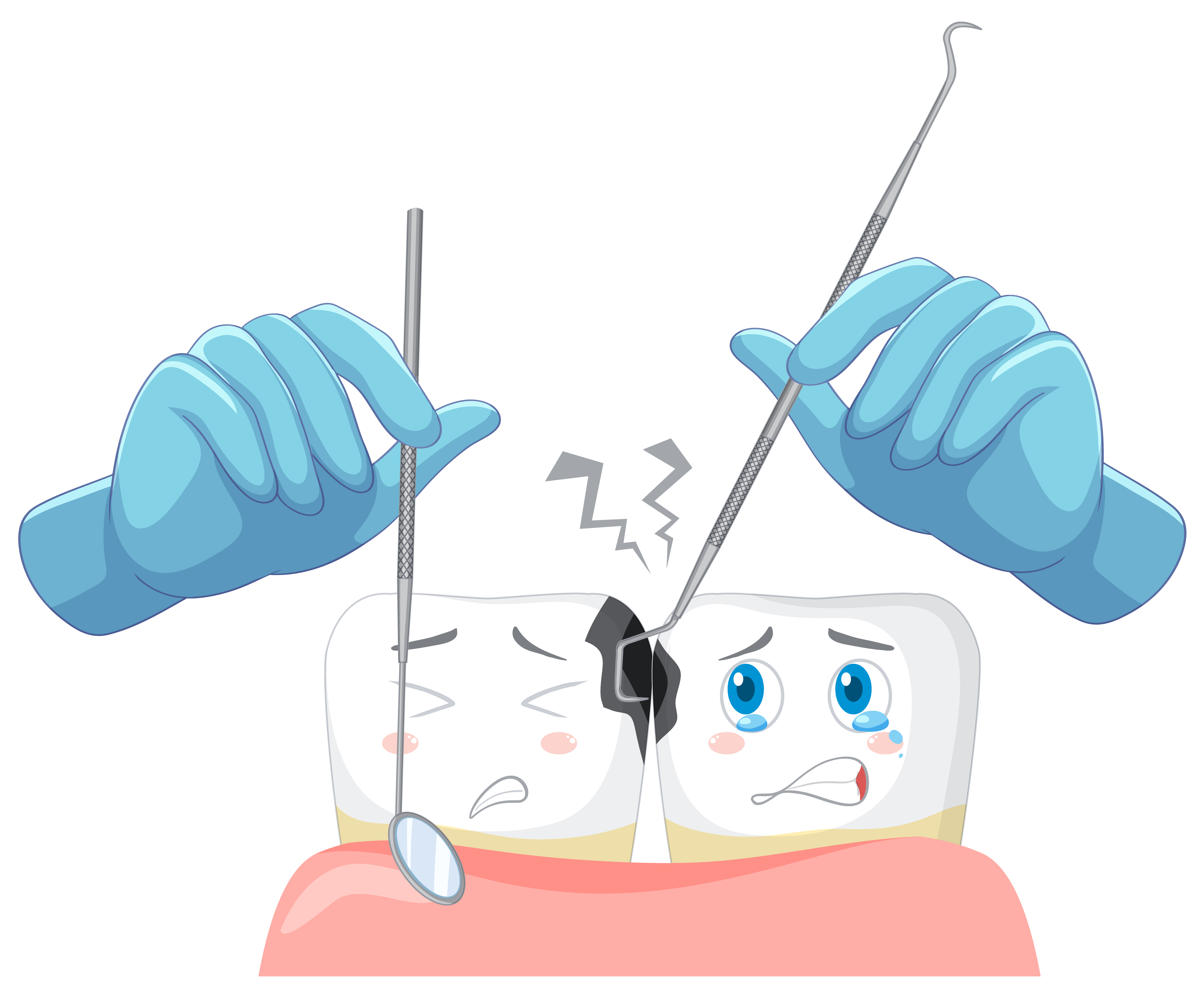 The Process of Getting a Wisdom Tooth Removed